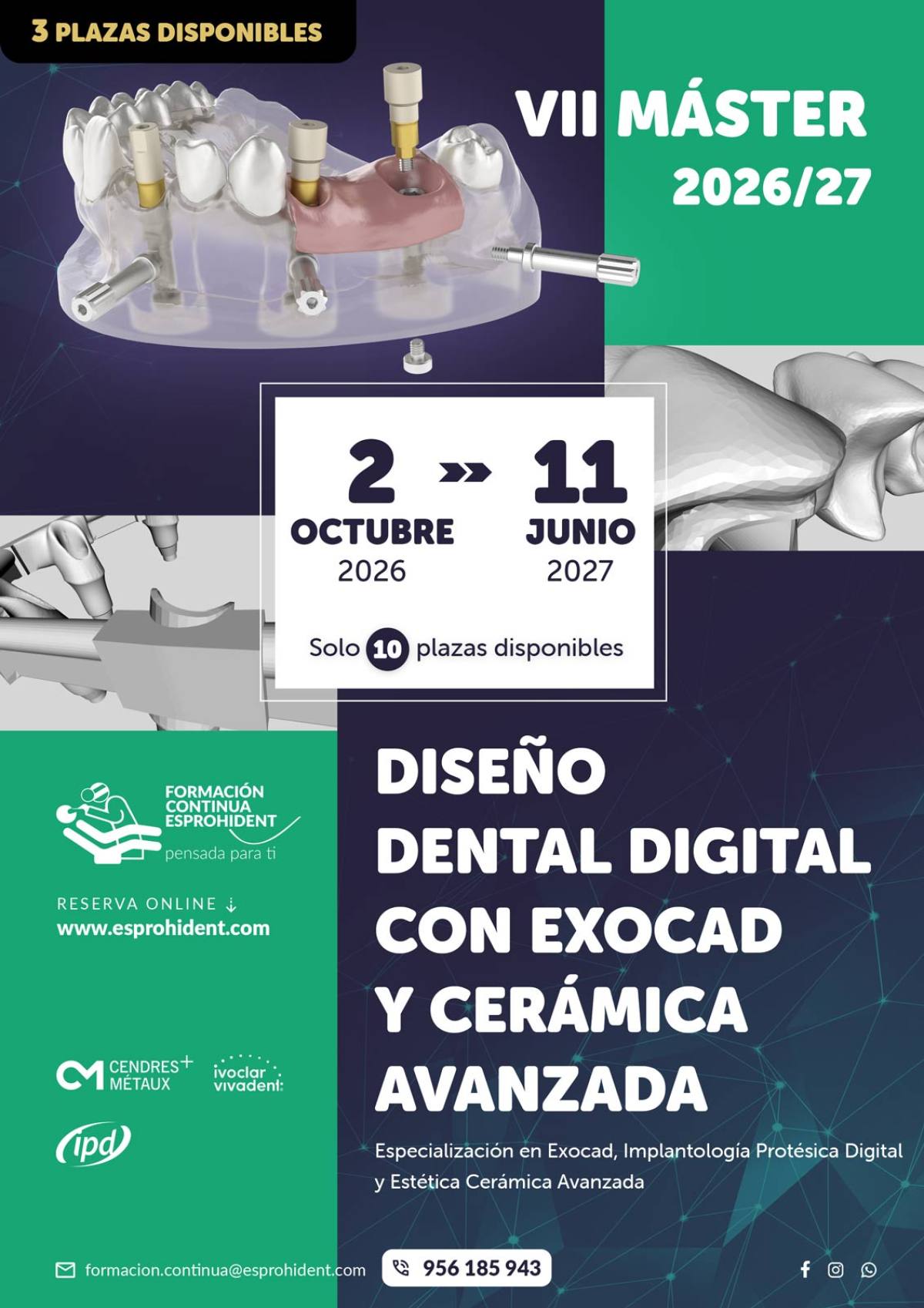 VII Máster en Diseño Dental Digital con Exocad y Cerámica Avanzada