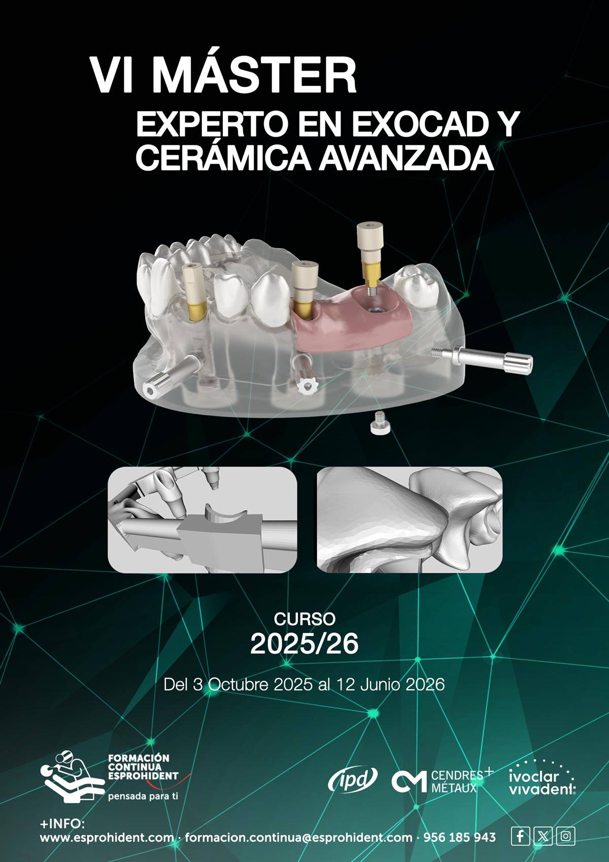 VI Máster Experto en Exocad y Cerámica Avanzada