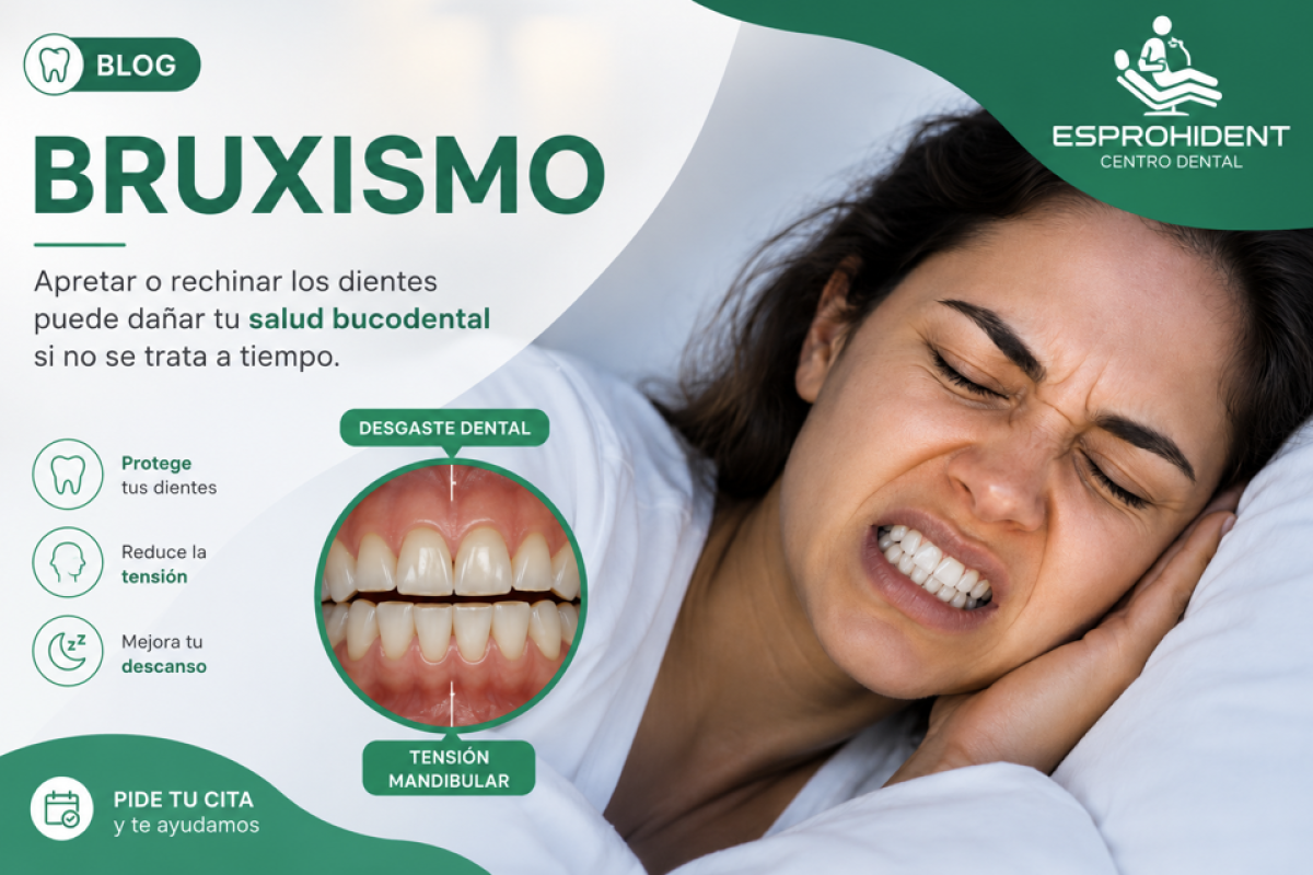 Bruxismo: cómo detectarlo y tratarlo antes de que dañe tus dientes