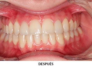 Estética Dental - Esprohident Clínica Dental en Jerez de la Frontera, Cádiz y Chiclana