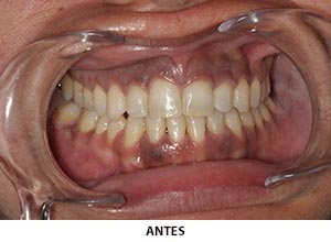 Periodoncia - Esprohident Clínica Dental en Jerez de la Frontera, Cádiz y Chiclana
